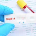 Test para el diagnóstico del COVID-19