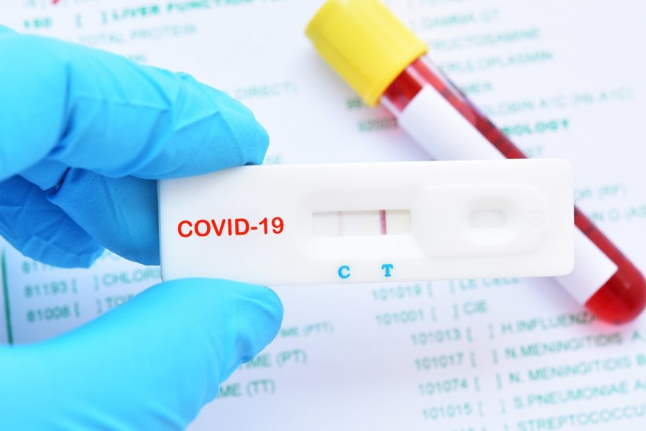 health covid 19 test