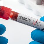 Llegan los Tests de Inmunidad Celular contra el Covid-19