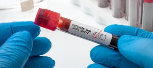 Llegan los Tests de Inmunidad Celular contra el Covid-19
