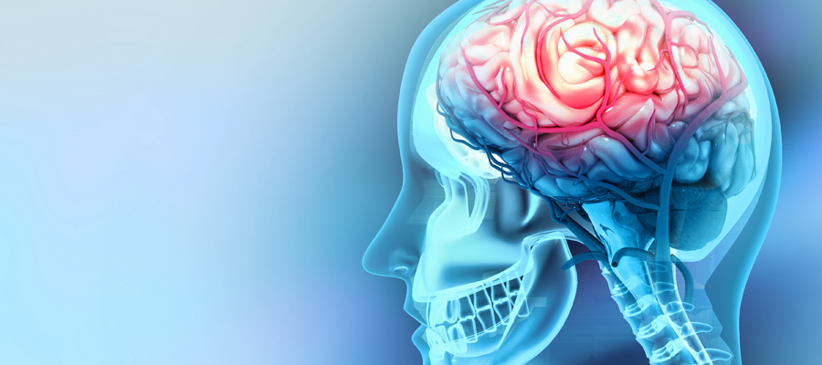 Identifican un nuevo biomarcador en el tumor cerebral más letal
