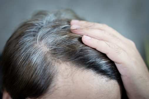 Si te arrancas una cana, ¿te salen 7 más?