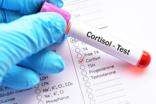 El síndrome de Cushing: ¿Cómo nos afecta el exceso de cortisol? Test hormonal de cortisol